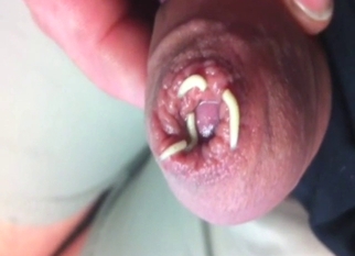 Bestiality sex with a dude and his maggots