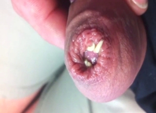 Bestiality sex with a dude and his maggots